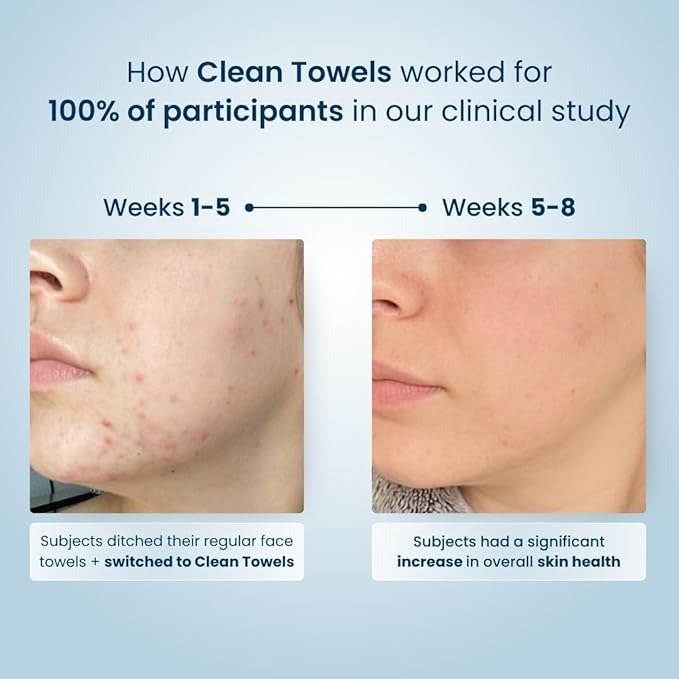 Clean Skin Club Clean Towels XL™, USDA Certified 100% Biobased Dermatologist Approved Face Towel, Disposable Makeup Remover Dry Wipes, Facial Wash (4 pack)